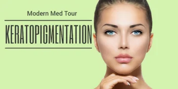 Keratopigmentasyon ile göz rengi değişimi