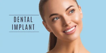 تمت مقارنة تكلفة زراعة الأسنان في إيران مع تكلفتها في الولايات المتحدة الأمريكية. في إيران، تتراوح تكلفة زراعة الأسنان بين 800 دولار و1000 دولار، بينما في الولايات المتحدة الأمريكية، تتراوح بين 1500 دولار و5000 دولار. يمكن القول بثقة أن زراعة الأسنان في إيران تكون أكثر توفرًا من حيث التكلفة مقارنة بالولايات المتحدة الأمريكية وبقية دول العالم.