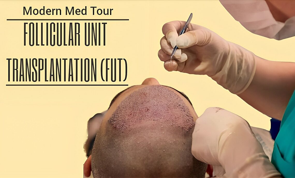 عند مقارنة تقنية عزل وحدات الجذعية الشعرية (FIT) بين إيران والولايات المتحدة الأمريكية، يمكن القول إن إيران تقدم هذا الإجراء الجراحي بتكلفة منخفضة لا تقدمها فقط الولايات المتحدة، ولكن أيضًا تتفوق على معظم دول العالم من حيث التكلفة. في إيران، تتراوح تكلفة FIT بين 1000 دولار و2000 دولار، مما يجعلها واحدة من أكثر الوجهات اقتصادية للمرضى الذين يبحثون عن هذا العلاج عالي الجودة. بفضل الأطباء المتميزين والمرافق الطبية المتطورة في إيران، يمكن للمرضى الحصول على رعاية طبية عالية الجودة بتكلفة معقولة. إذا كنت بحاجة إلى إجراء FIT بأفضل الأسعار على مستوى عالمي، فإن إيران تعتبر وجهتك المثلى.