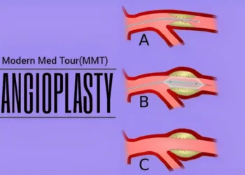 الأنجيوبلاستي(Angioplasty)