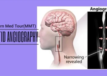 التصوير التاجي للشريان السباتي(Carotid angiography)