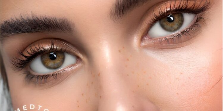 استئصال الكاتاراكت وزراعة العدسة