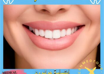 ابتسامة هوليوود(Hollywood Smile): التعريف والأنواع