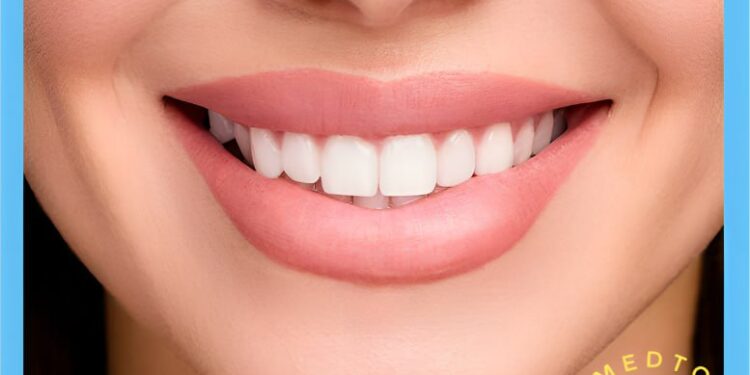 ابتسامة هوليوود(Hollywood Smile): التعريف والأنواع