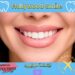 ابتسامة هوليوود(Hollywood Smile): التعريف والأنواع