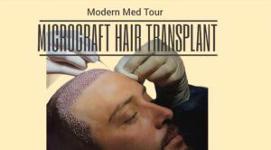 زراعة الشعر بالميكروغرافت (Micrograft Hair Transplant) في إيران، هي إجراء جراحي يُستخدم لعلاج مشاكل فقدان الشعر وتراجع خط الشعر. يُعتبر هذا الإجراء فعّالًا لاستعادة الشعر الطبيعي والكثيفة في المناطق التي تعاني من تساقط الشعر.