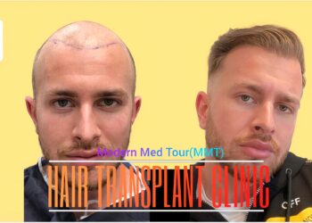 إيران تبرز كوجهة رائدة عالمية لزراعة الشعر في الرأس، حيث تقدم هذه الخدمة بتكاليف أكثر بأمانة بكثير مقارنة بالعديد من البلدان الأخرى. بينما تبلغ تكاليف زراعة الشعر في الرأس في الولايات المتحدة الأمريكية والمملكة المتحدة وإيطاليا مستويات مرتفعة تصل إلى الآلاف من الدولارات، تتراوح التكاليف في إيران بين 1000 و2000 دولار. هذا يتيح للمرضى الاستفادة من نفس الجودة والكفاءة العالية في الخدمة الطبية، مما يجعل إيران وجهة مفضلة للعديد من الأشخاص الباحثين عن إجراء زراعة الشعر. مع الأسعار المعقولة والخبرة الطبية الممتازة، تعتبر إيران الخيار الأفضل على الصعيدين الاقتصادي والجودة لزراعة الشعر في العالم.