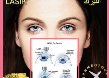 لاسيك (LASIK) في إيران : تعريف وأنواع