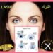 لاسيك (LASIK) في إيران : تعريف وأنواع