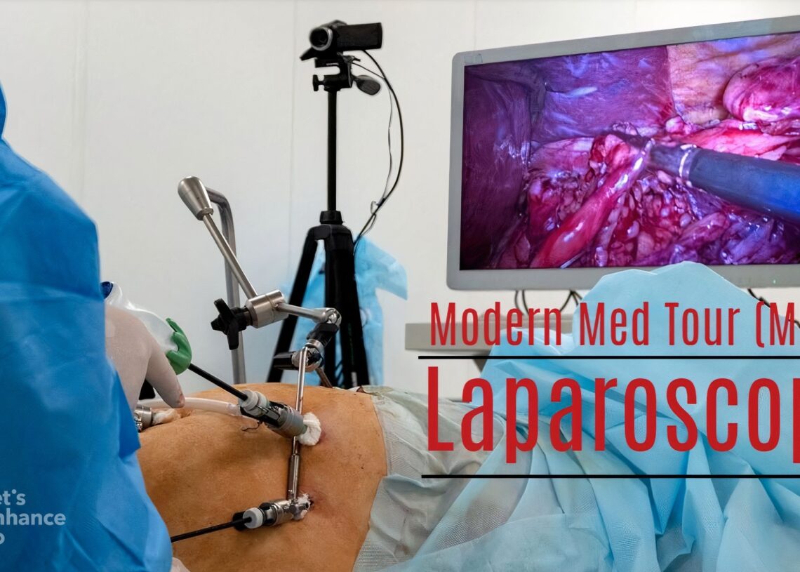 جراحة المنظار (Laparoscopy Surgery)