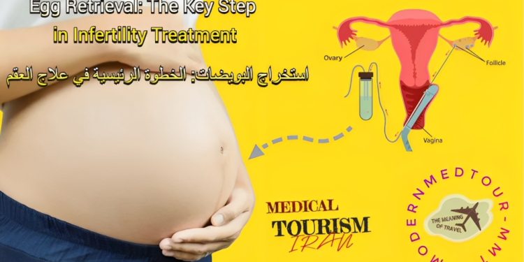 استرجاع البويضات (استرجاع الأووسيت)