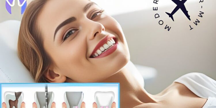 علاج قناة الجذر(Root Canal Treatment): التعريف والأنواع