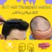 أسلوب زراعة الشعر SUT