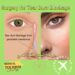 جراحة انسداد قناة الدمع(Tear Duct Blockage)في إيران