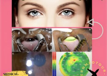 تصليد الكولاجين بالأشعة فوق البنفسجية (UVX) في إيران