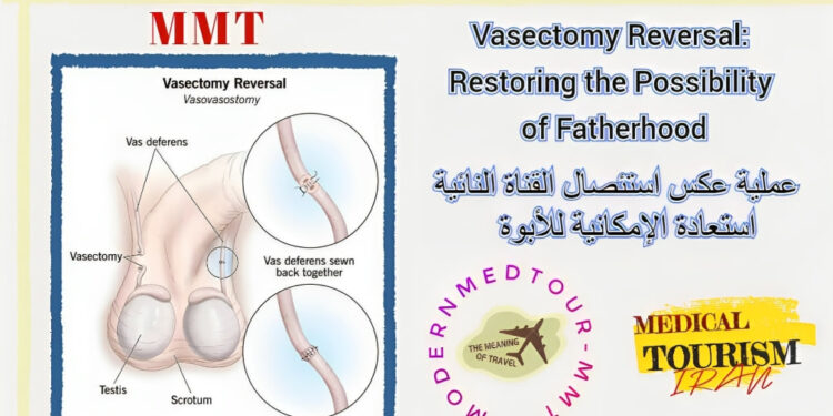 إعادة وصل القناة الدافقة (Vasectomy Reversal)