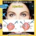 حقن الزيت السيليكوني داخل الزجاجية(Intravitreal Silicone Oil Injection): التعريف والأنواع