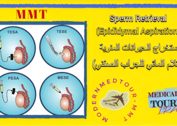 علاج العقم للرجال: استفراز الحيوانات المنوية