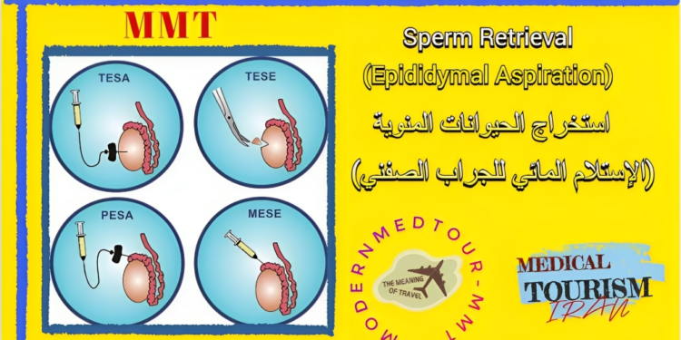 علاج العقم للرجال: استفراز الحيوانات المنوية