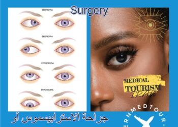 جراحة تقويم العيون (Strabismus): استعادة التوازن البصري