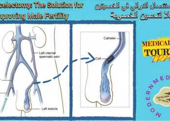 جراحة الوريد الدوالي الخصية (Varicocelectomy): تعريف وأنواع
