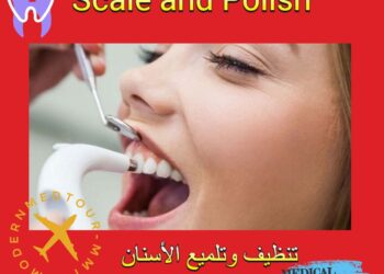 تنظيف وتلميع الأسنان