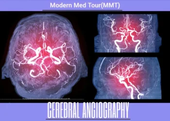 تصوير الشرايين الدماغية(cerebral angiography)