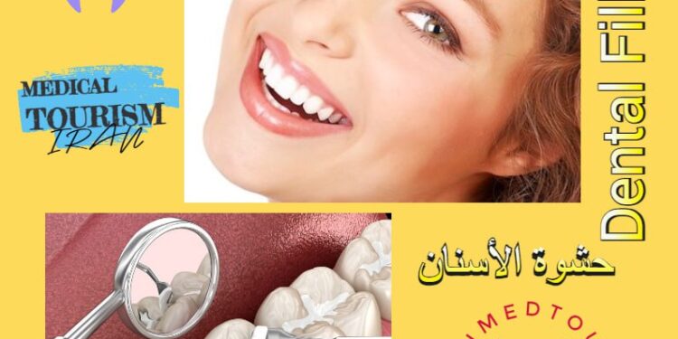 تعبئة(حشوة) الأسنان: تعريف وأنواعها