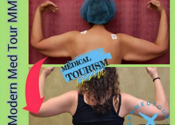 رفع الذراع (Arm Lift) في إيران