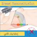جراحة إعادة بناء الثدي (Breast reconstruction surgery) في إيران