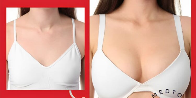 زراعة الثدي (Breast Augmentation)