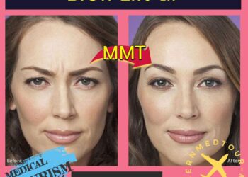 رفع الحاجب (Brow Lift) في إيران