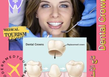 تيجان الأسنان (Dental Crowns) تعريف وأنواع