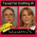 زراعة الدهون في الوجه(Facial Fat Grafting): أنواعها وتعريفها في إيران