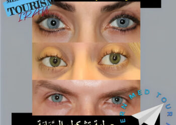 رأب القزحية(Iridoplasty): أنواع وتعريف في إيران