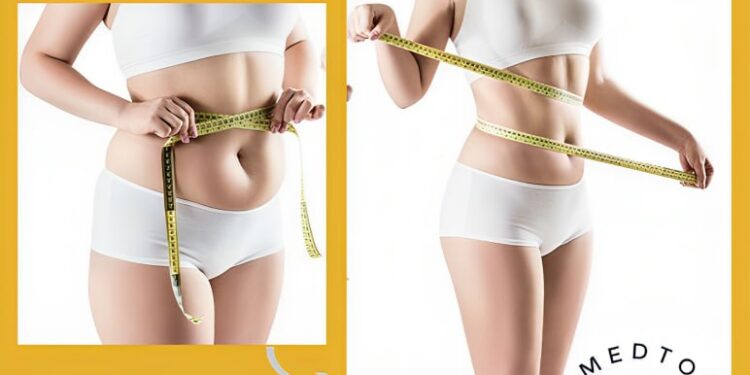 شفط الدهون (Liposuction)