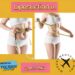 شفط الدهون (Liposuction)