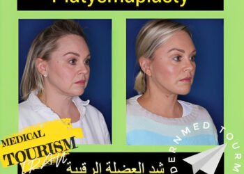 رأب العضلة العاصرة(Platysmaplasty): أنواعه وتعريفه في إيران