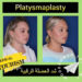 رأب العضلة العاصرة(Platysmaplasty): أنواعه وتعريفه في إيران