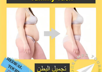 تجميل البطن (Tummy Tuck)