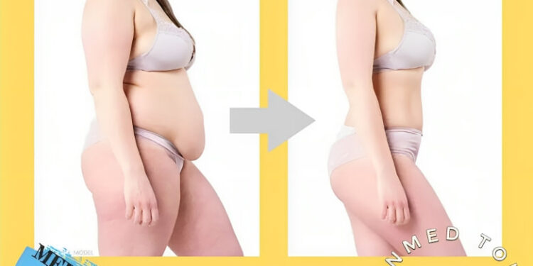 تجميل البطن (Tummy Tuck)