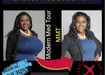 جراحة تصغير الثدي (breast reduction surgery) في إيران