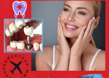 الزراعة السنية: أنواعها وتعريفها