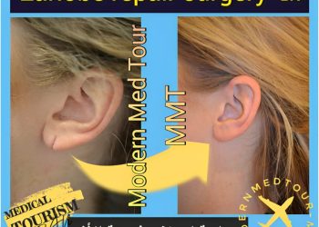 جراحة إصلاح الشحمة(earlobe repair surgery): تحسين مظهر الأذن بفعالية