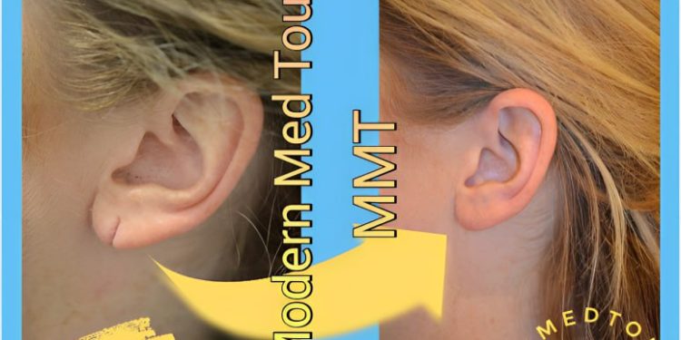  جراحة إصلاح الشحمة(earlobe repair surgery): تحسين مظهر الأذن بفعالية