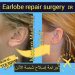  جراحة إصلاح الشحمة(earlobe repair surgery): تحسين مظهر الأذن بفعالية