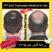 زراعة الشعر بتقنية FIT في إيران