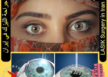 جراحة الليزك في إيران
