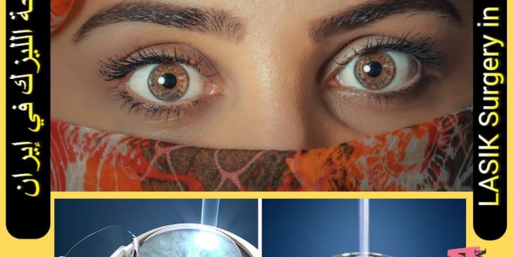 جراحة الليزك في إيران
