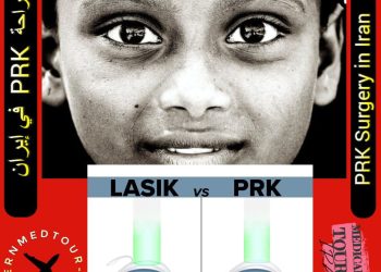 جراحة PRK في إيران